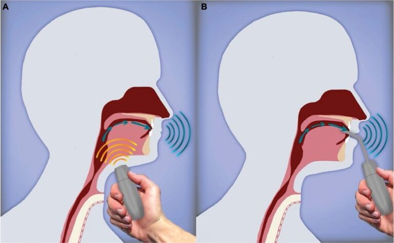 Electrolarynx How To Guide