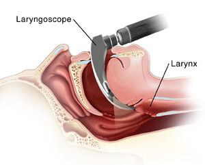 002-labextrade.com-Laryngoscopy (1) 002-labextrade.com-Laryngoscopy