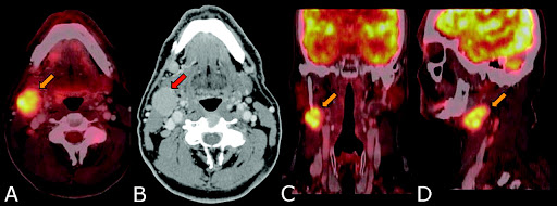 002-labextrade.com-PET-scan-positron-emission-tomography-scan