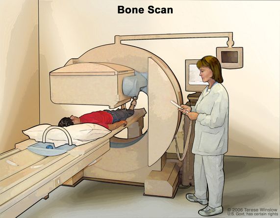 002-labextrade.com-bone-scan