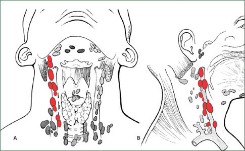 Learn More About The Different Throat Cancer Operations, Hypopharyngeal Cancer, Labex Trade