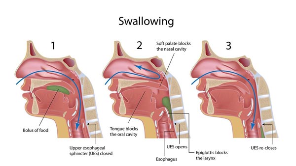 C Ncer De Am Gdalas Etapas S Ntomas Y Opciones De Tratamiento   005 Labextrade.com Tonsil Cancer7 Small 