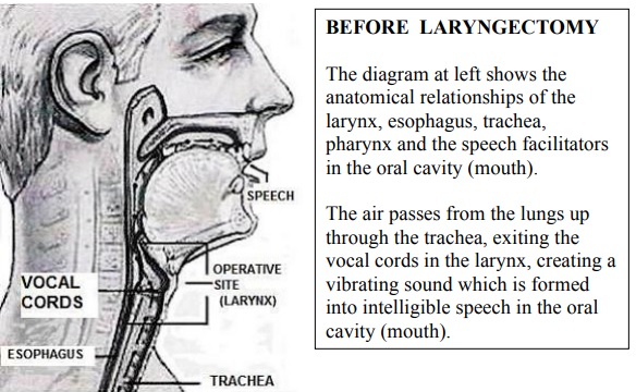 Being A Laryngectomee And What To Expect, Labex Trade